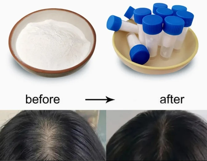 Biotinoyl Tripeptide-1 Biotinoyl Tripeptide-1